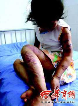 霹雳彩虹林亚男