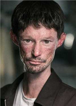 小小陌生人年轻男性患者