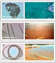 图1 群体和丝状产毒蓝藻显微和水华图片