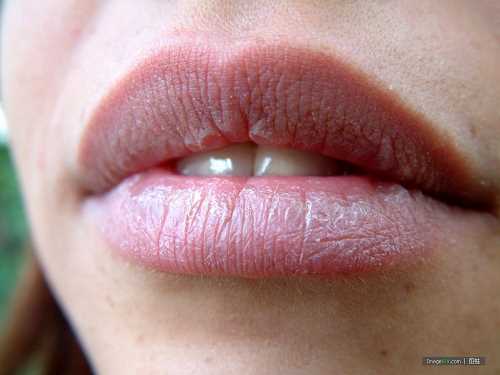 淀粉酶导致嘴唇干燥